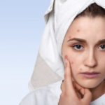 dicas para tratar e prevenir a acne